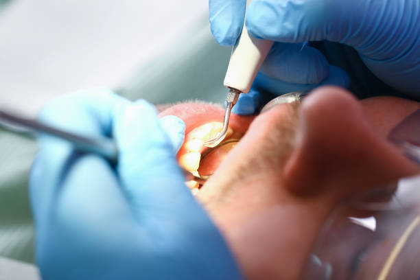 Best Emergency Treatment for Toothache in Cedar Springs, MI